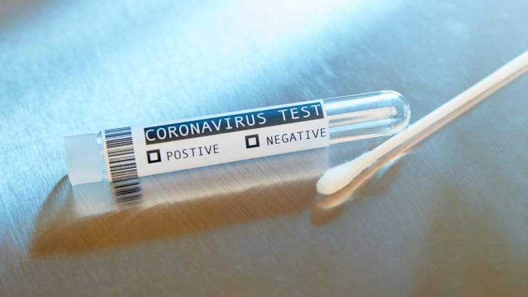 a coronavirus test